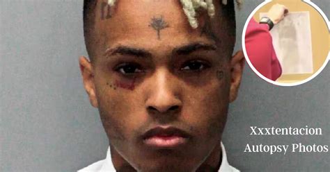 xxxtentacion death autopsy|XXXTentacion’s Alleged Autopsy Report Surfaces。